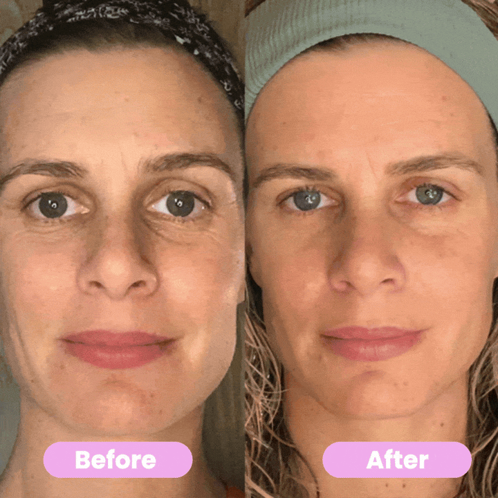 7-in-1 LED Face Firming & Massage Tool – Vénera-White-Nora Luxe