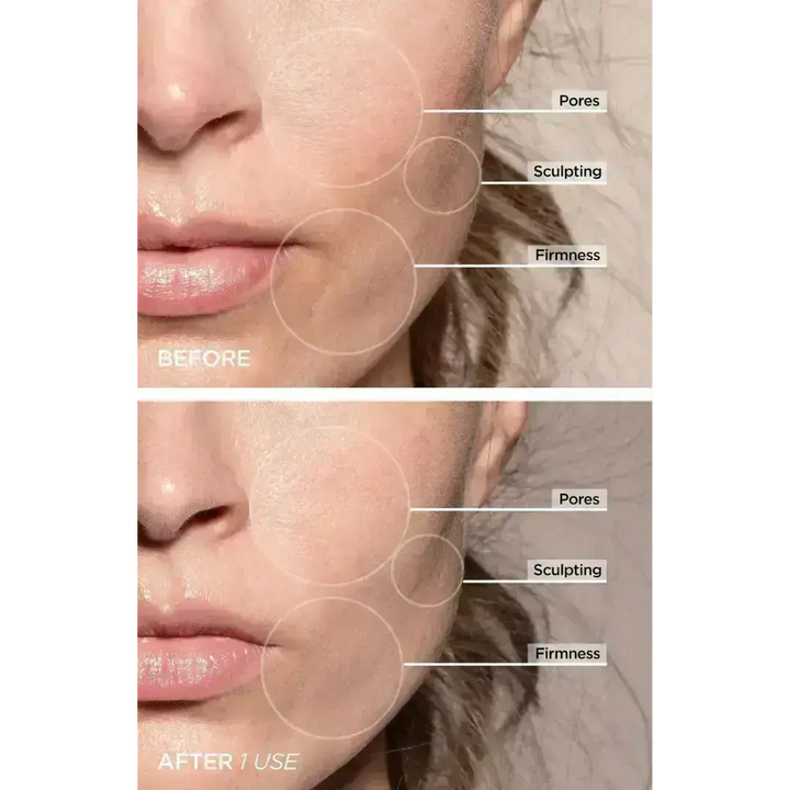 7-in-1 LED Face Firming & Massage Tool – Vénera-White-Nora Luxe