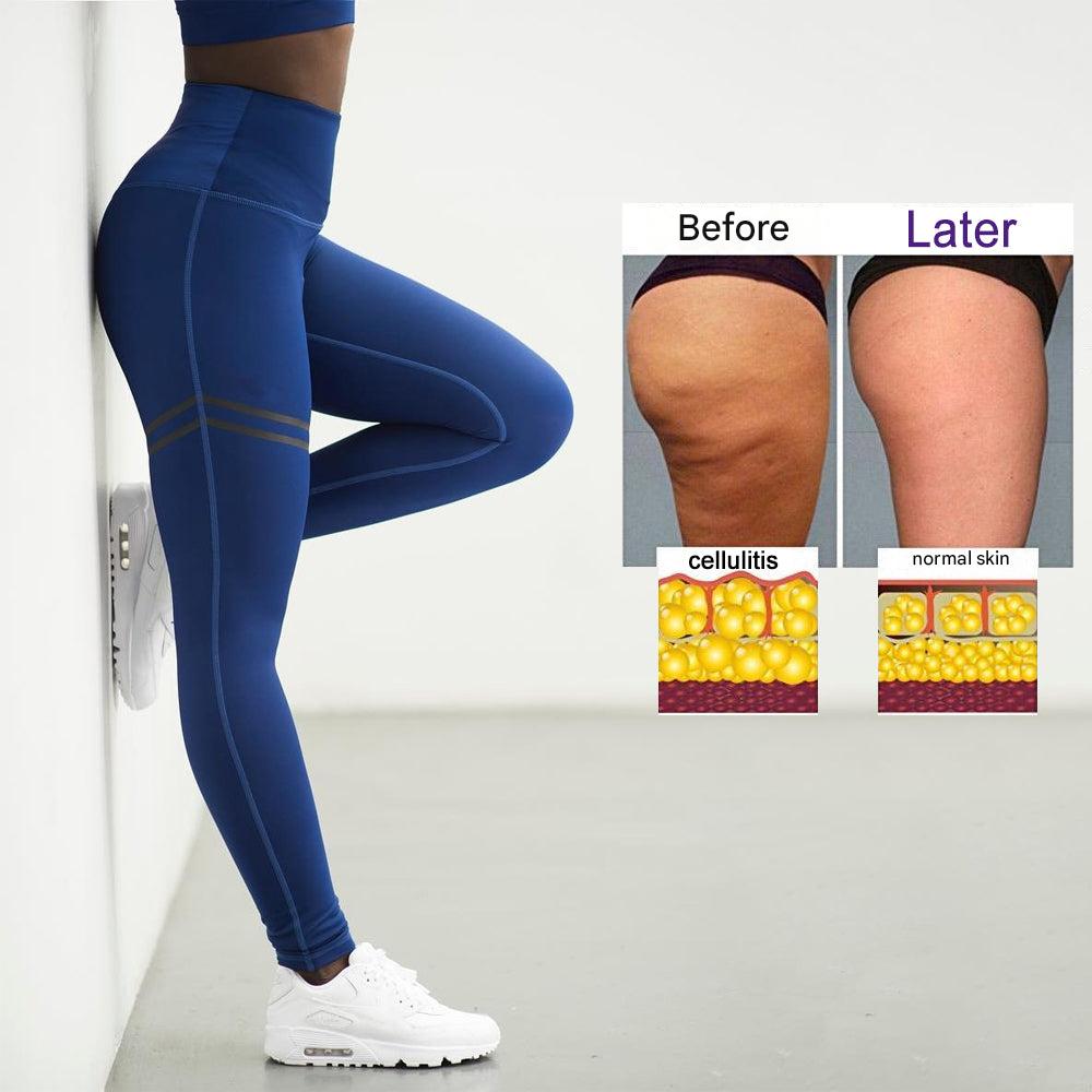Anti-Cellulite Compression Leggings for Women - SculptFit-Black-S-Nora Luxe