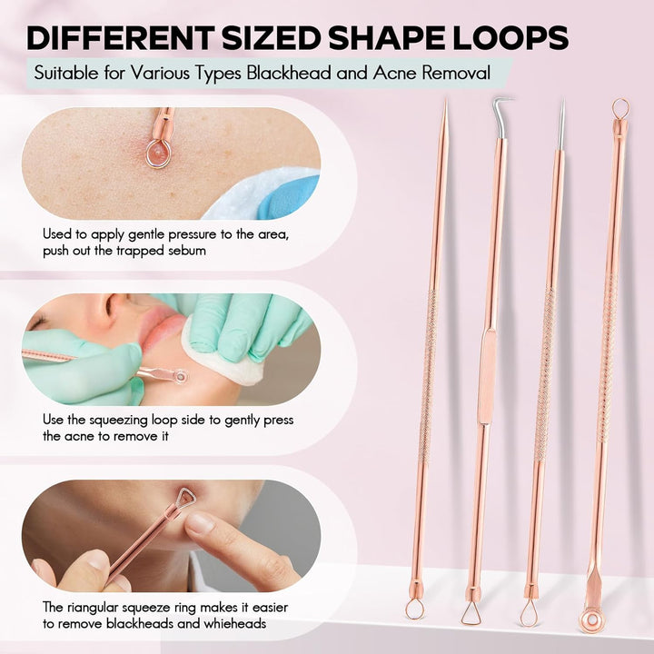 Blackhead & Pimple Extractor Kit-Nora Luxe