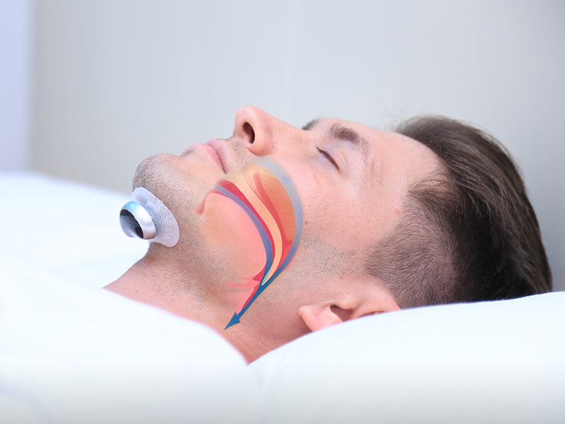 Comfortable Anti-Snoring Device - QuietWave-Anti-snoring device-Nora Luxe