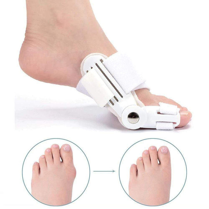 Corrective Splint for Hallux Valgus (1 Pair) - BunionFix-White-Nora Luxe