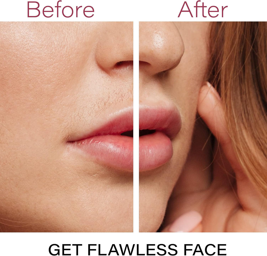 Flawless Facial Hair Remover – Discover Smooth Skin Now!-Rose Gold-Nora Luxe