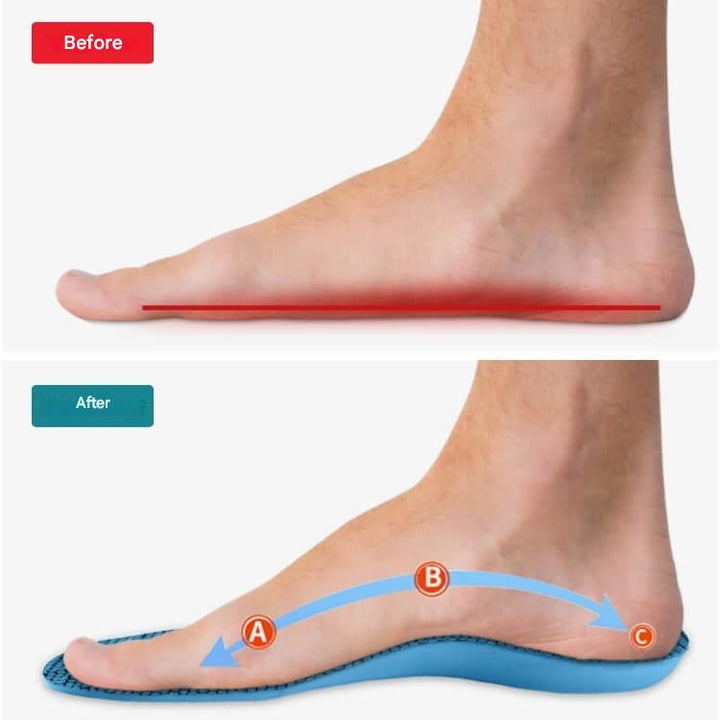Orthopaedic Insoles – StepRelief-4-5.5-Nora Luxe
