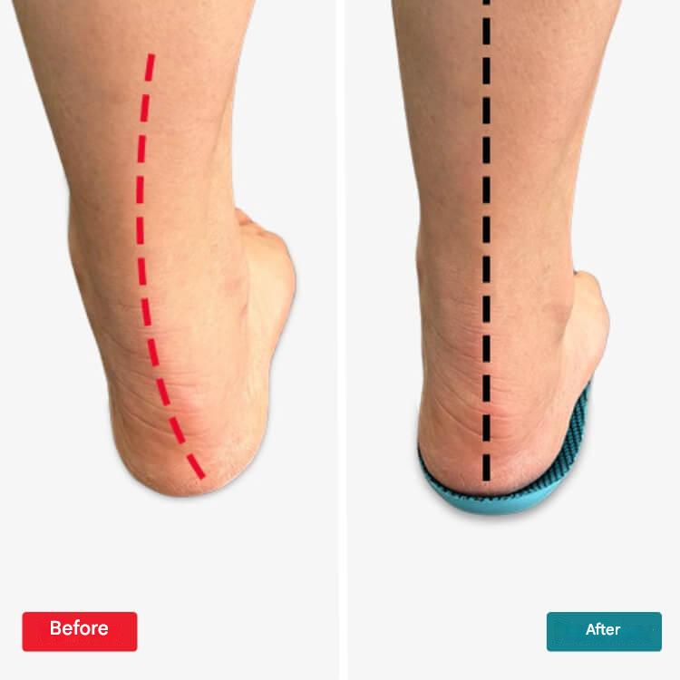 Orthopaedic Insoles – StepRelief-4-5.5-Nora Luxe