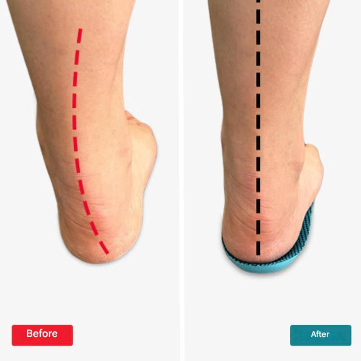 Orthopaedic Insoles – StepRelief-4-5.5-Nora Luxe