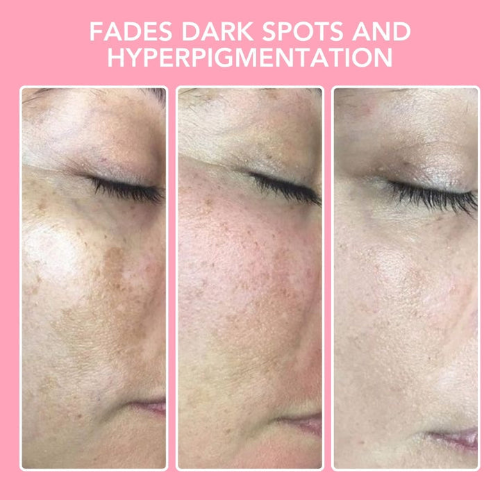 Turmeric Kojic Acid Cleansing Pads - GlowTonic-The Livary